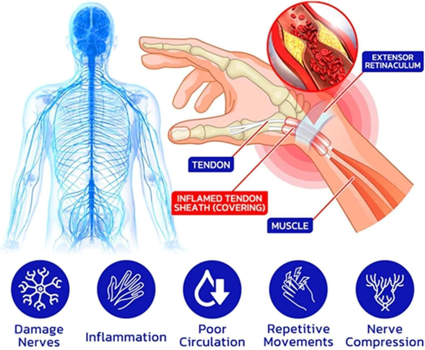 Numbfix Hands and Foots Spray for Discomfort Caused by Joints, Numbfix Hands and Foots Spray for Applies to Everyone