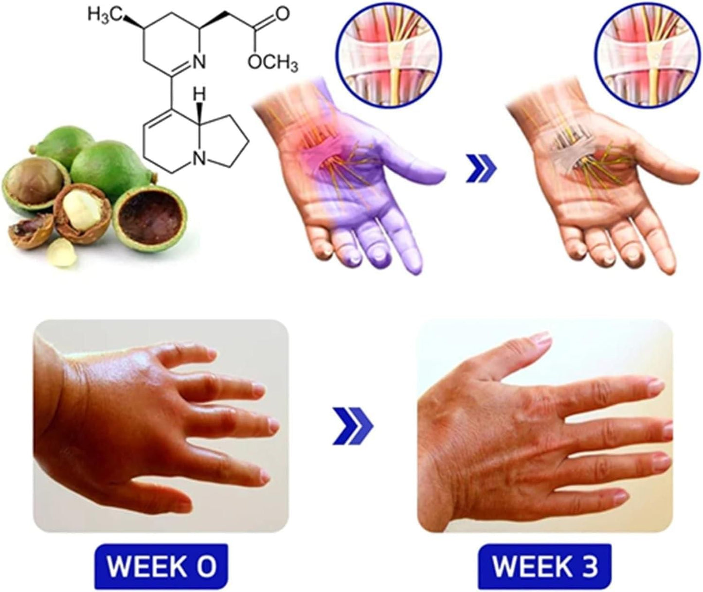 Numbfix Hands and Foots Spray for Discomfort Caused by Joints, Numbfix Hands and Foots Spray for Applies to Everyone